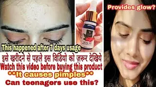 Good Vibes Rose Hip Serum Honest Review in Hindi | Non-Sponsored | Sayne Arju