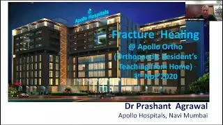 Fracture Healing by Dr Prashant Agarwal
