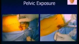 Modulating Spine Deformity with Non-Fusion