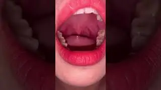 Asmr doktor tungue#youtubeshorts #tongue #asmr #asian #youtube #viral #fyp #tiktok #lipstik