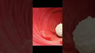 WBC count || CBC || TLC || Leukemoid  reaction || leukocytosis#shorts #wbcs #cbc #tlc #biology #neet