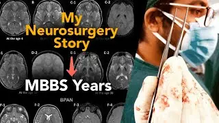 MBBS Years - My Interest In Neurosurgery