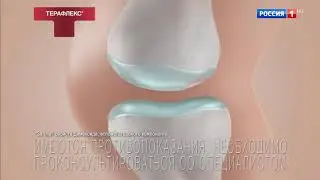 Реклама Терафлекс крем — Сильнее сустав, здоровее сустав (2018)
