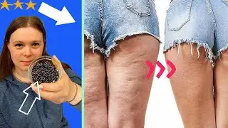 Как избавиться от целлюлита на бедрах и ногах за 2 недели естественным путем и без тренировок
