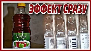 Протирайте ЭТИМ Лицо ВЕЧЕРОМ и Кожа Без Морщин и Пятен Даже в 70 лет! Рецепт маски от морщин.