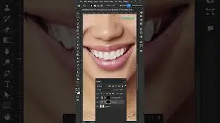 How to make teeth white