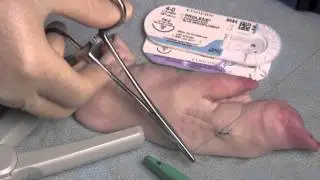 Laceration Repair (simple repair)