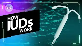 How IUDs prevent pregnancy (3D Animation)