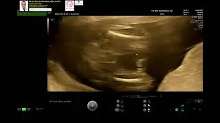 20-week routine checkup