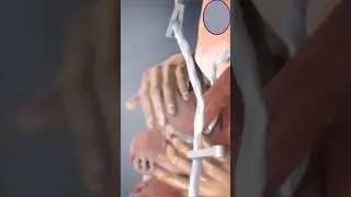Placenta Removal Animation 