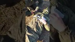 Нюанс возможной остановки кровотечения.