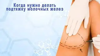 Когда нужно делать подтяжку молочных желез