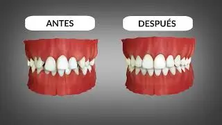 Ortodoncia Invisible 3D - Grupo Dental Clinics 2026