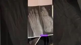 ПОЕХАЛИ В ТРАВМПУНКТ ПОСЛЕ ДНЯ РОЖДЕНИЯ! 