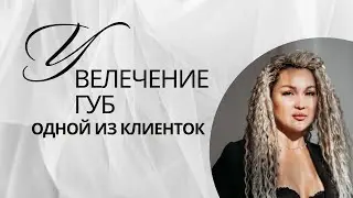 УВЕЛЕЧЕНИЕ ГУБ/ ВЕСЬ ПРОЦЕСС/ ФИЛЛЕРЫ/ГИАЛУРОНОВАЯ КИСЛОТА/ДО ПОСЛЕ