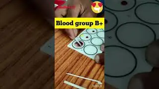 Blood group | abo blood group || B positive blood group #shorts #bloodgroup #dayinthelife #viral