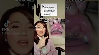 #tanyamindok