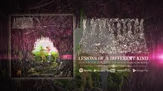 UNDEATH - LESIONS OF A DIFFERENT KIND (OFFICIAL AUDIO)