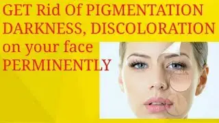 how to get rid of pigmentation ,darkness, discoloration of face