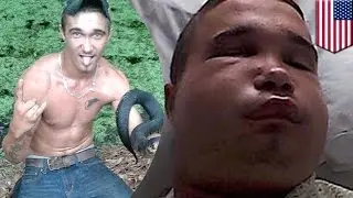 Remaja bodoh mencoba mencium seekor ular berbisa - TomoNews