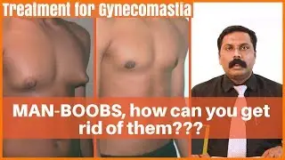 What is Gynecomastia and how common is it? Gynecomastia Man Boobs | Dr. Sunil Kumar KS, MHW