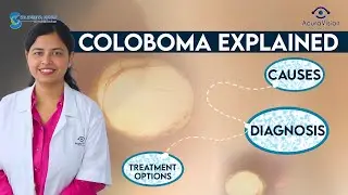 Coloboma Explained: Causes, Diagnosis, and Treatment Options | Dr. Shreya Nayak