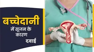 बच्चेदानी में सूजन के कारण और उपाय. Bulky Uterus treatment. by Dr.Babita Rathore