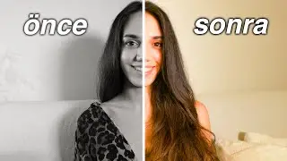 BİBERİYE YAĞI İLE HIZLI SAÇ UZATMA🌿 Biberiye yağı saça nasıl uygulanır, faydaları, öncesi ve sonrası