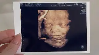 PREGNANCY VLOG: Nursery Update and 3D/4D Ultrasound!