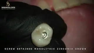 שיקום פה בשלוש פגישות