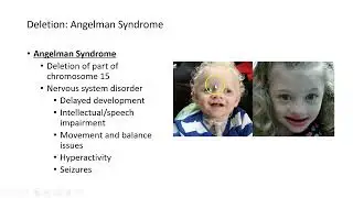 Chromosomal Abnormalities: Deletions and Duplications