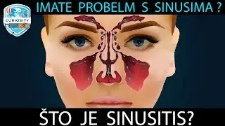 Sinusitis -Kako pobijediti sinusitis i udahnuti punim plućima!  #Dr 110