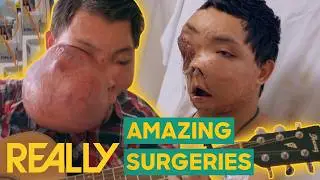 "I Couldn't Eat" Extreme Surgeries And Their Amazing Results | Body Bizarre
