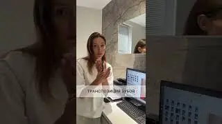 Транспозиция зубов