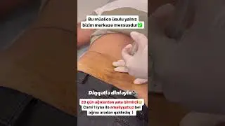 Bel ağrısına SON❗️ #keşfet #youtubeshorts #belağrısı #proloterapi