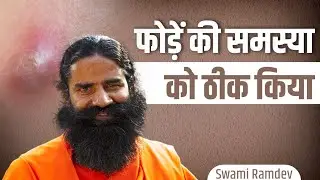 फोड़ें (Boils) की समस्या को ठीक किया || Swami Ramdev