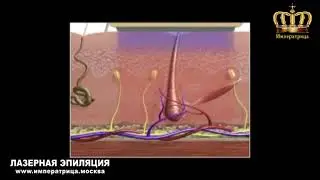 Лазерая эпиляция против волос.