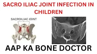 SACRO ILIAC JOINT INFECTION IN CHILDREN - EPISODE 66