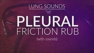 Pleural Friction Rub | Pleural Rub