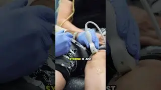 How to alleviate knee pain without surgery? 
