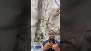 He didn’t shower for 5 YEARS! Doctors reaction 