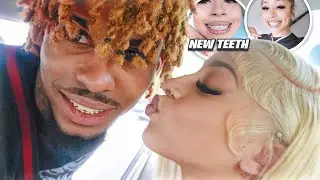 I GOT MY TEETH DONE + I Flew To See A SPECIAL SOMEBODY…