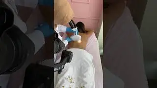 Lazer işlemleri için çekimlerimiz devam ediyor.