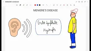 MENIERE'S DISEASE
