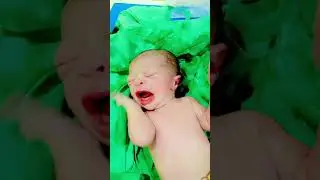Crying baby afterbirth#short#viral#trending