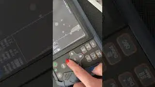 ECO12 vet ultrasound how to adjust the image shape