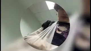 Некоглай сломал руку...