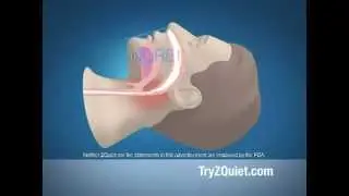Official ZQUIET Commercial As Seen On TV