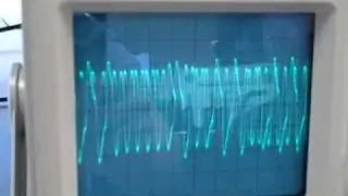 HART signals on oscilloscope