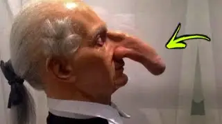 10 Unusual People With Bizarre Body Parts You Won’t Believe Exist